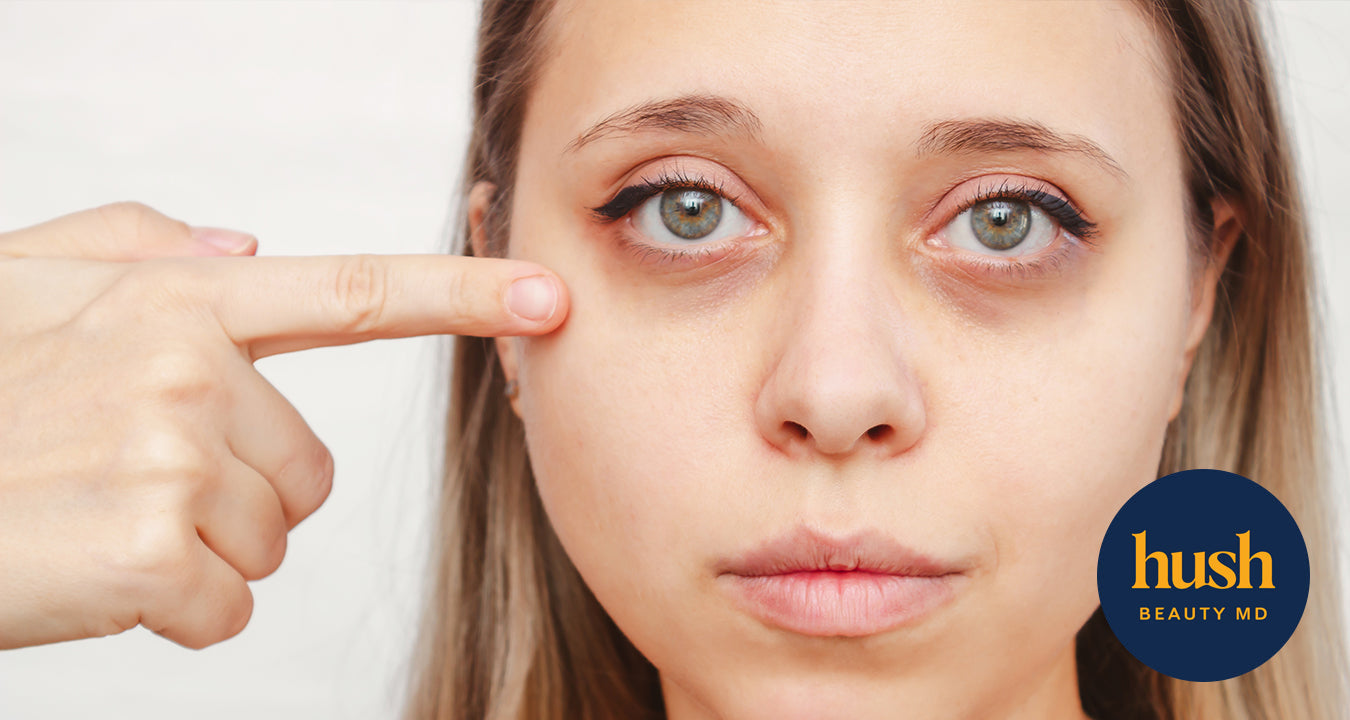 Why Eyebags Persist and How to Get Rid of Them