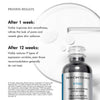 NEW: Skin Ceuticals P-TIOX Serum