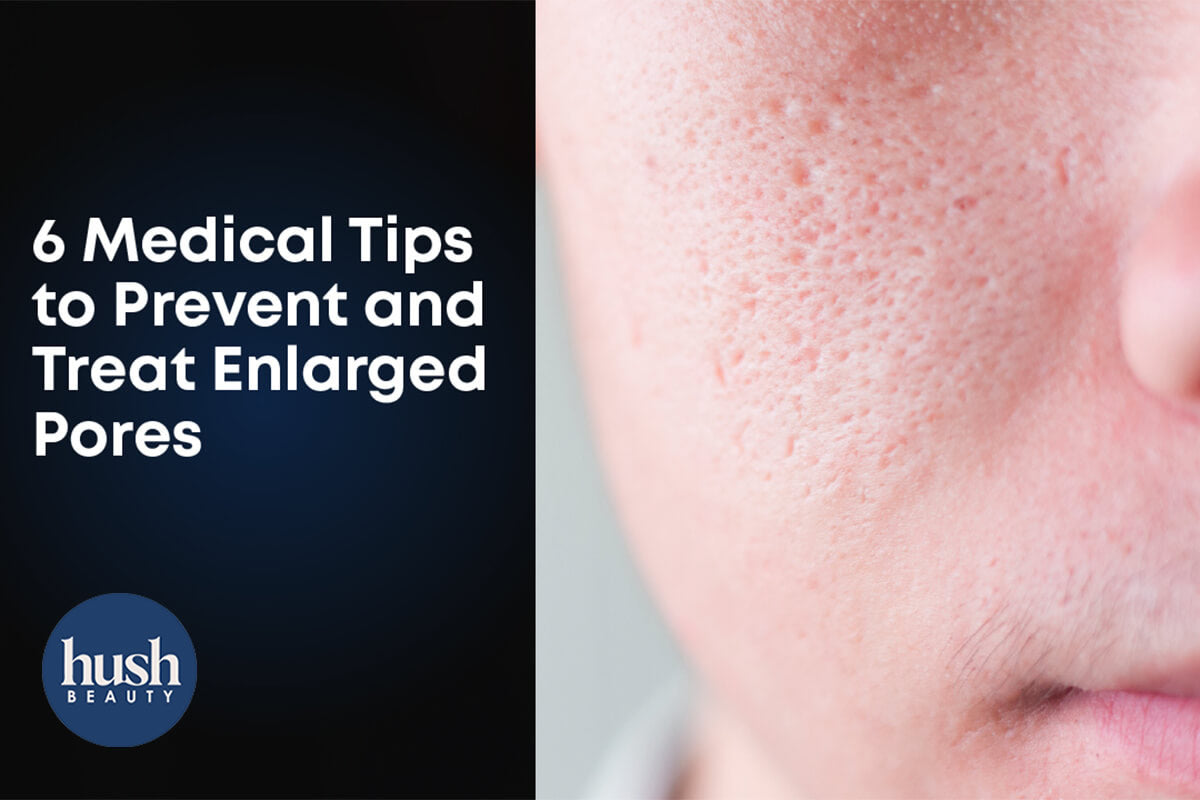 6 Medical Tips To Prevent And Treat Enlarged Pores