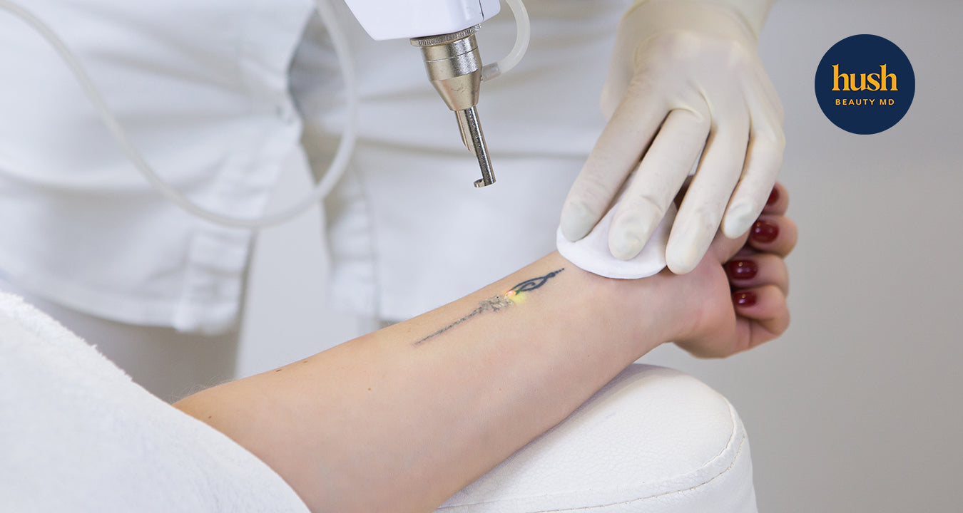 Caring for Your Skin After Laser Tattoo Removal
