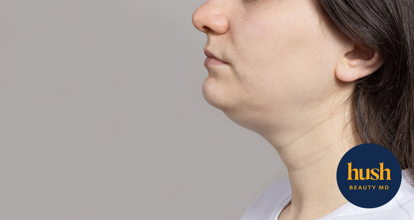 How to Get Rid of a Double Chin