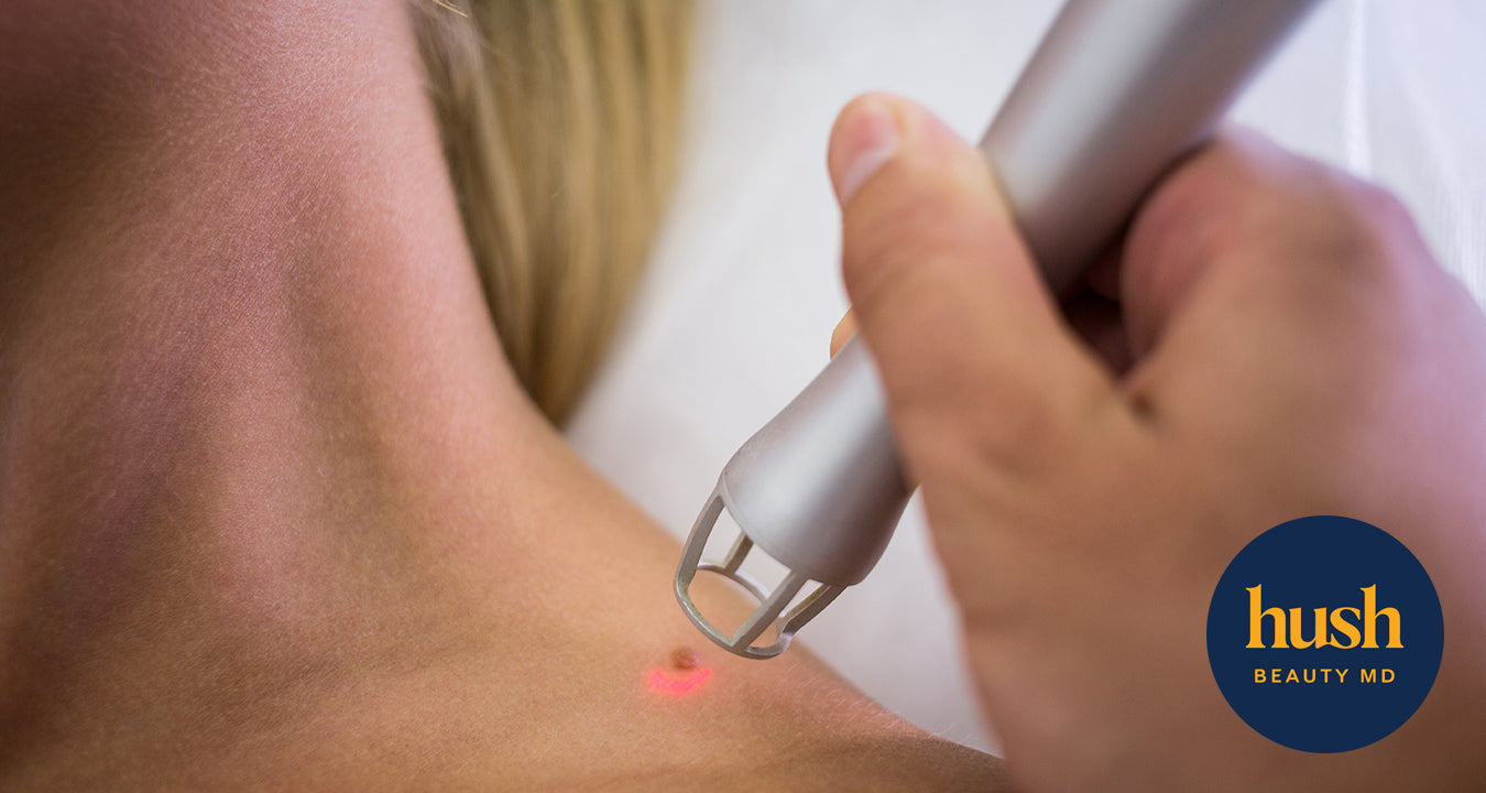Unlocking Radiance: A Comprehensive Guide to Effective Scar Treatment