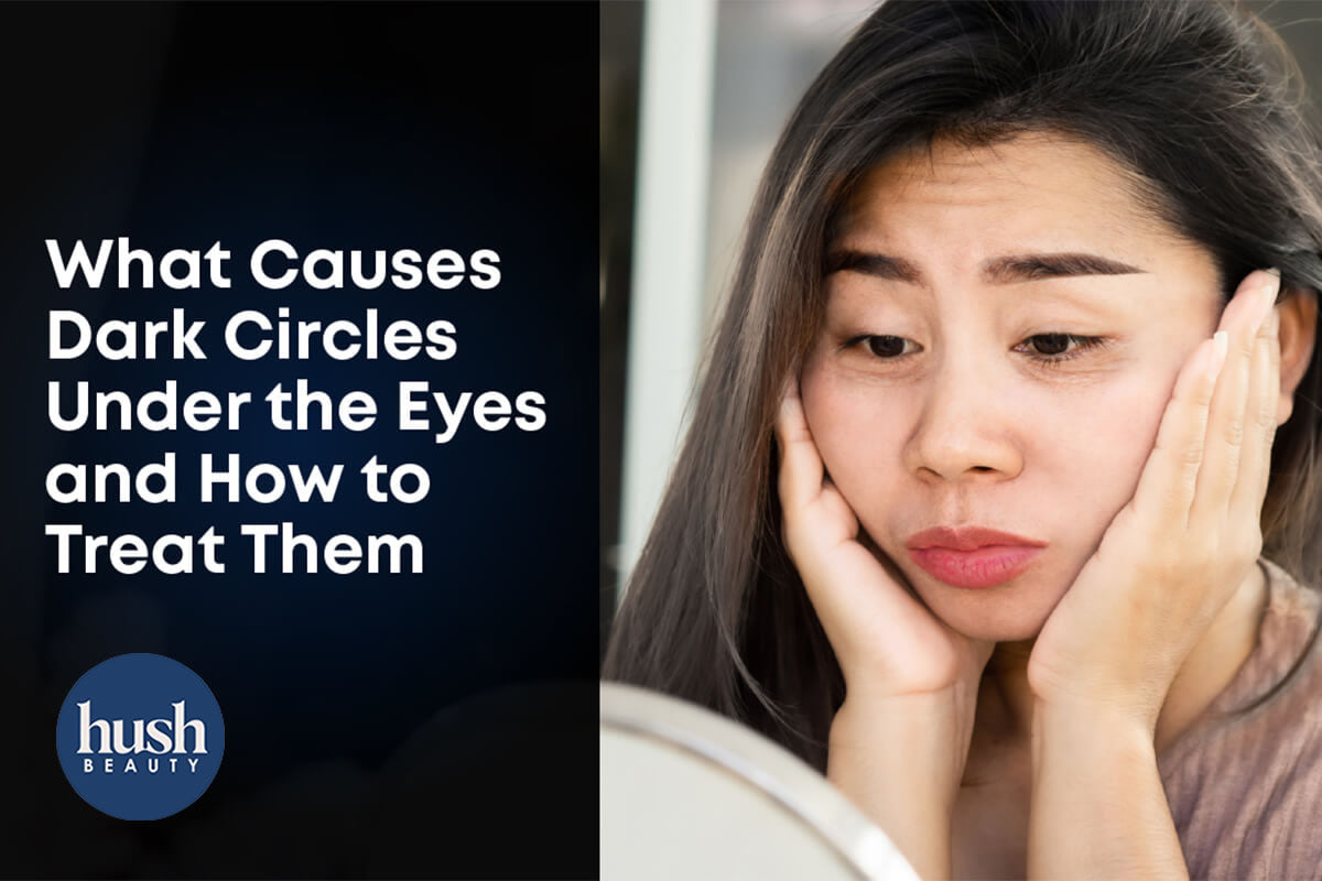 What Causes Dark Circles Under The Eyes And How To Treat Them
