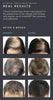 AnteAGE MD Hair Solution