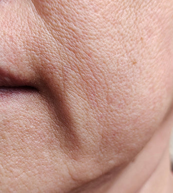 Jowls