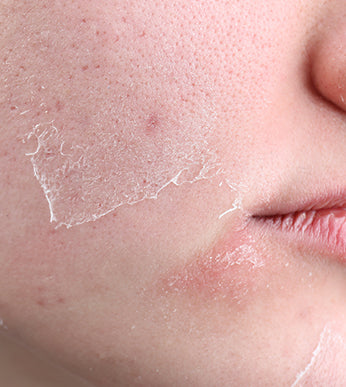 Dull Skin