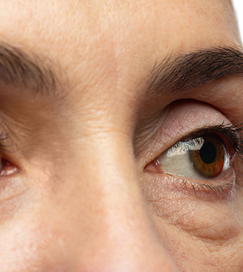 Eye Bags