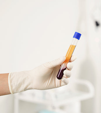 PRP Treatment