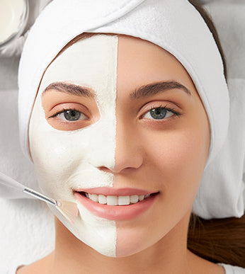 Chemical Peels