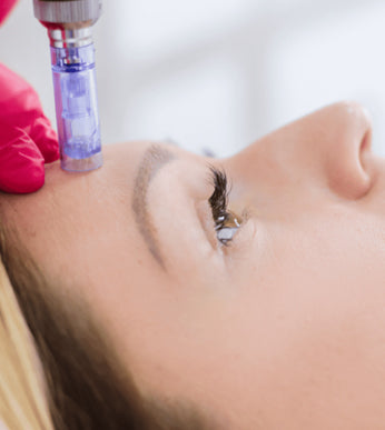 Microneedling